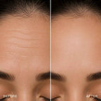 Lova Light Mask - Revitalize Your Skin with Light Therapy